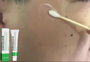 EELHOE ครีมทาฝ้า Remove Spot Cream กำจัดฝ้า จุดด่างดำ ฝ้า กระ ริ้วรอย ลดเม็ดสีเม บอกลาปัญหากระ ครีมจางรอยสิว Acne cream รอยสิวจางลง อย่างอ่อนโยน ไม่ระคายเคือง ปฏิเสธการเกิดสิวกำเริบ เซรั่มกำจัดสิว ครีม ครีมแต้มสิว