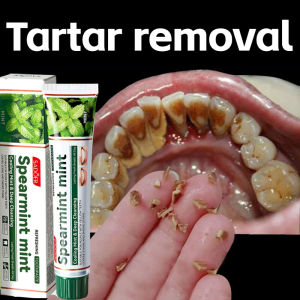 Whitening Toothpaste Pemutih Gigi Ubat Gigi removal tartar bad breath removal yellow stains 100g Oral Hygiene restoring damaged gums
