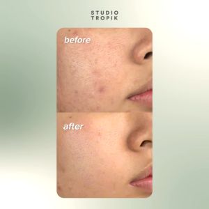 Studio Tropik Herbitus Skin Tonic 30ml: Tonik Kulit Alami untuk Wajah