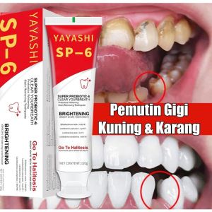 SP-6 Pasta Gigi Pemutih Soda Kue Memutihkan Gigi Menghilangkan Karang Gigi Odol Pemutih Gigi Dan Karang Gigi 100% Orisinal Pasta Gigi Yang Menyegarkan Nafas Menghilangkan Gigi Kuning Dan Karang 120ml