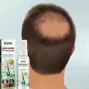 Semprotan Pertumbuhan Rambut 100ML - Serum Penumbuh Rambut Cepat & Anti Botak