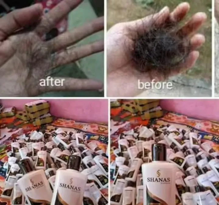TERLAEISS%20NOMOR%201%20Shampo%20pemanjang%20dan%20perawatan%20rambut%20rontok%20,Shampo%20antiketombe%20dan%20pembasmikutu%20-%20Image%206