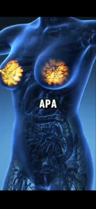 PROMO Black Garlic bawang Kating Premium Obat Herbal 100 GR 250 GR 500 GR