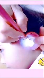 Bộ lấy ráy tai cao cấp có đèn led bộ dụng cụ lấy ráy tai bằng thép không gỉ kèm hộp đựng sang trọng