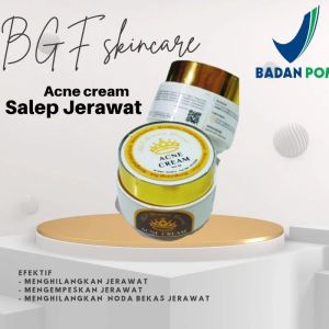 Salep Jerawat Ajaib