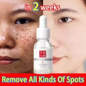 Whitening Freckle Serum Perbaikan Kulit Anti-Penuaan Asam Hyaluronic Whitening Perawatan Kulit Essence Wajah Perawatan Anti Kerut Mengencangkan Kulit Gold Polypeptide Serum