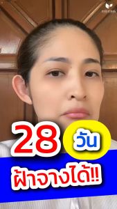 โซลูชั่น ครีมทาฝ้าซองน้ำเงิน 1กล่อง (6ซอง) + แถมเพิ่มอีก 1 ซอง