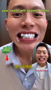 Kem đánh răng làm trắng kem đánh răng probiotic kem đánh răng làm trắng loại bỏ vết ố răng bụi bẩn vết trà bảo vệ nướu làm thơm hơi thở 120G