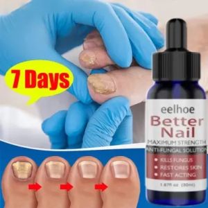 Nail Repair Essence Serum 50ml Antibacterial Nail Treatments Essential Oil | Nail Care Improve Infection | Serum Penghilang Jamur Di Kuku | Vitamin Kuku Rusak | Memperbaiki Kuku Rusak