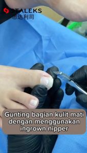 STALEKS - Ingrown Nail Nipper Smart 71 -14mm Full Jaw