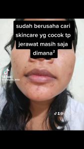 SABUN KIME BELI  1 DAPAT 2