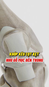 Viên khớp Anbone (Traphaco) - Hỗ trợ làm trơn ổ khớp hạn chế lão hóa khớp (hộp 30 viên)