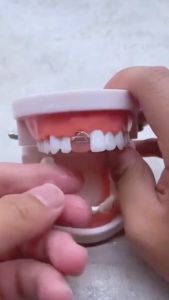 PROMO!!! TEMPTOOTH 800 BUTIR / TEMTOOTH / Gigi Temporary / Penambal Gigi / Gigi palsu