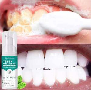 OUHOE MOUSSE TEETH WHITENING Ubat gigi pemutih gigi membersih gigi dan memutih gigi kuning