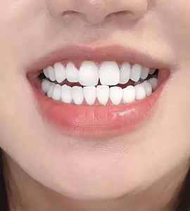 ubat gigi pemutih halal toothpaste whitening teeth pemutih gigi ubat gigi buang karang gigi pembersih Fresh Breath 美白牙齿牙膏