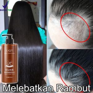 Shampoo Anti Rambut Rontok Jahe: Solusi Untuk Rambut Pria
