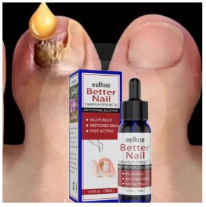 Antibacterial Nail Treatments Essential Oil 50ml Nail Care Improve Infection | Perawatan Kuku Berjamur | Serum Penghilang Jamur Di Kuku | Vitamin Kuku Rusak | Memperbaiki Kuku Rusak