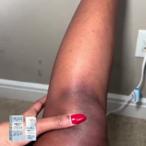 EELHOE | Eelhoe Private Parts Whitening Cream Underarms Knees Lighten Color Reduce Dark Color Moisturize Brightening Buttock Cream New
