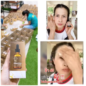 Q Double Serum เซรั่มคิว ( แพ็ค 5 กล่อง ) เซรั่มบำรุงผิวหน้า ฝ้า กระ จุดด่างดำ