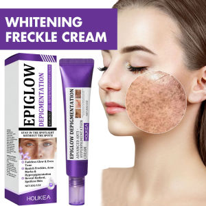 Whitening Freckle Cream Melasma Dark Spots Pigmentation Removal Product Fade Stain Melanin Fast Repair Brighten Korean Skin Care