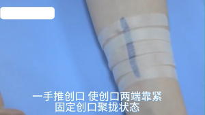 Sterile First Aid Skin Wound Closure Surgical Bandage Without Sutures Postpartum Wound Repair Steri Strip Adhesive Skin Repair