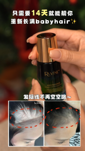 【Merdeka Sale】RUVINE Hair Essence 30ml | Plant-Based Hair Growth Serum for Hair Fall & Thinning Hair
