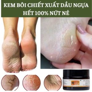 [MUA 1 TẶNG 1] Kem dầu ngựa 30g cải thiện tình trạng nứt nẻ chân tay  á sừng nước ăn chân nhiều chất dinh dưỡng giúp giữ ẩm làm lành các vết nứt gót chân.