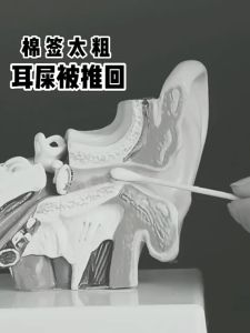 100 ชิ้น ก้านไม้ สำลี ใช้ปั่นหู ใช้สำหรับบาดแผล สะอาดปลอดภัย เครื่องมือแคช่หู ไม้พันสำลี