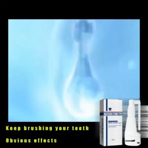 Jaysuing Tartar Removal Spray Dental Calculus Dissolving Oral Spray Tartar Cleaning Spray Teeth Cleaner 30ml