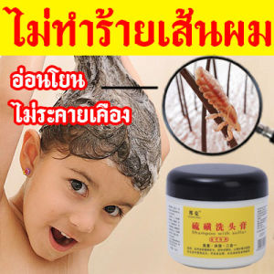 เส้นผมที่ช่วยให้คุณดูหายใจได้ของขจัดรังแค และหลังจากฝักบัวอาบน้ำแบบทูอินวัน ยาสระผมเชื้อรา สระผมเหมือนน้ำหอม รังแคแห้ง อาการคันจากรากหนังศีรษะ และเป็นขั้นตอนการควบคุมความมัน ของคุณ หรือการใช้บริการของแชมพู ให้ได้ถูกต้องและปลอดภัย สร้างคว