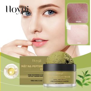 Mặt Nạ Sét Kaolin HOYGI 100g Dành Cho Da Nhờn - Tẩy Tế Bào Chết Nhẹ Nhàng Loại Bỏ Mụn Đầu Đen Với Thành Phần Cacao & Trà Xanh Làm Sạch Lỗ Chân Lông Thuần Chay