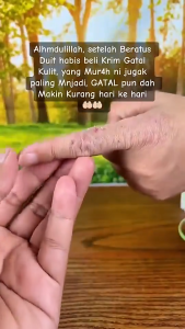 Buy 1 Take 1 Baiyorang Wet Venom Cream Official Anti-itch Thigh Inner Skin Private Parts External Use Wet Venom Cream Genuine