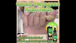 Jaysuing  Cecair Perawatan Kuku Halia   Penyelesaian Penjagaan Kuku untuk Tangan dan Kaki Pent Kuku Lembut Cecair Pelembap untuk Kulat Kuku