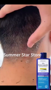 Anti Dandruff Shampoo 1% Ketoconazole Anti Dandruff Scalp Treatment Volumizing 200mlStrong Flake Fighter • Itch & Oil Control Remover Treatment Anti Fungal