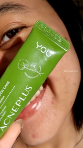 YOU - AcnePlus Triple Action Spot Care | Totol Jerawat - Ken Herbal