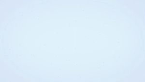 ขวดนมเด็กทารก PPSU ขวดนมป้องกันโคลิก 300 มล พิมพ์ขวดนมขนาด 300 มล สำหรับการช่วยเตือนอาหารเด็ก