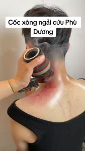 Cốc xông ngải cứu | Cốc phù dương xông ngải cứu đông y | Cốc gốm xông ngải tặng bao thổ cẩm