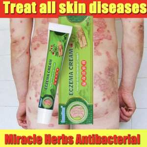 Herbal Antibacterial Cream Mild Formula No Side Effect Psoriasis Treatment Eczema Treatment Gamot sa Buni Effective Ointment