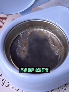 ANGELALIGN | Ultrasonic Cleaner for Invisible Aligners Retainers Braces and Dentures