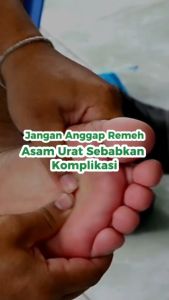 ASMURATHIB PREMIUM OBAT HERBAL MENGATASI ASAM URAT NYERI SENDI REUMATIK PEGAL LINU PADA TULANG ASLI ORIGINAL BPOM