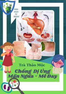 Trà Cải Thiện Dị Ứng mẩn ngứa mề đay 40 túi lọc Trà Đông Y Việt