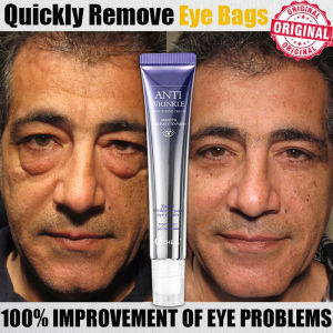 Retinol Eye Cream Eye Bag Removal 20g Eye Cream Dark Circles Remover Fine Lines Anti Aging Eye Wrinkle Care Massager Lifting Eye Cream