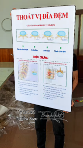 Tranh phòng khám y khoa tranh xương khớp tranh đốt sống cổ Tranh Y khoa triệu chứng bệnh thoát vị đĩa đệm tráng gương treo tường YQC48