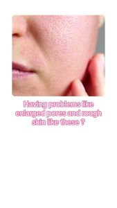 SKIN1004 Madagascar Centella Poremizing Fresh Ampoule Tender Care 100ml