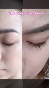 Serum Dưỡng Dài Mi 5T LASH| Dưỡng Dài Mi Làm Dài và Dày Mi Hiệu quả sau 2 tuần sử dụng