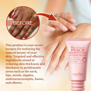 SADOER | Fast Brighten Dark Knuckles Cream Whiting Hand Cream Lighten Melanin Stains Corrector Hand Anti Crack Soften Moisturize Product