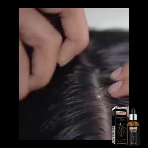 WEST&MONTH Natural Intense Hair Treatment Essential Oil 30ml Nourishes And Repair The Scalp Promotes Hair Growth Improves Dryness And Frizz