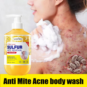 Anti Acne Body Wash 500ml Sulfur Shower Gel Removes Acne And Mites Whitening Shower Gel Whitens And Brightens Skin 硫磺除螨沐浴露