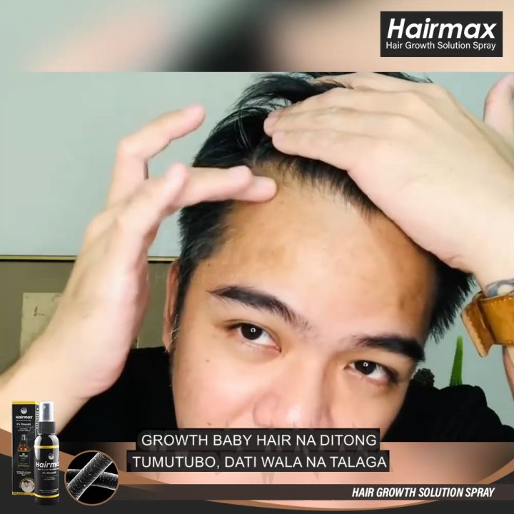 [Buy1 Take1 Today] Hairmax Hair Growth Minoxidil Serum Spray fast hair growth hair grower original