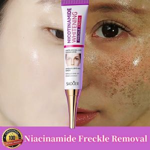 Ready Stock Original Whitening Freckle Serum Melanon Dark Spot Skincare krim jeragat degil berkesan pigmentation remover20G烟酰胺美白祛斑